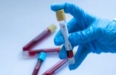 Um profissional de laboratório agarra várias colheitas de sangue onde se lê H1N1,  vírus da  gripe A. Crédito: Canva