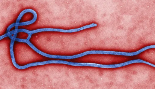 Ebola-notas-para-hoje-e-para-amanha