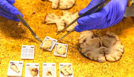 Mãos com luvas azuis manipulam amostras de tecido cerebral, em cima de mesa de laboratório.